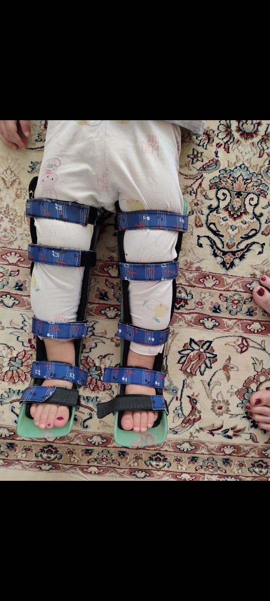 پای پرانتزی کودک پای پرانتزی کودک