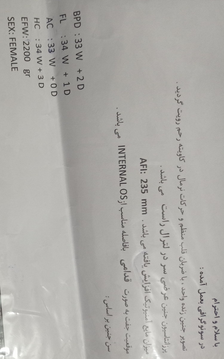 تفسیر سونوی ۳۴هفتگی و تاریخ زایمان تفسیر سونوی ۳۴هفتگی و تاریخ زایمان