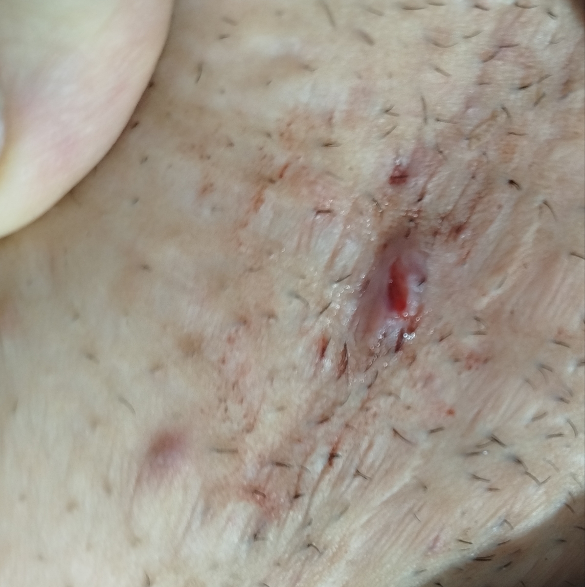 سرگیجه و احساس ضعف در پا سرگیجه و احساس ضعف در پا