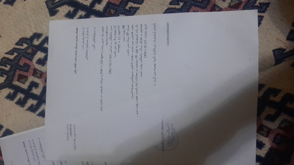 این سونو این سونو