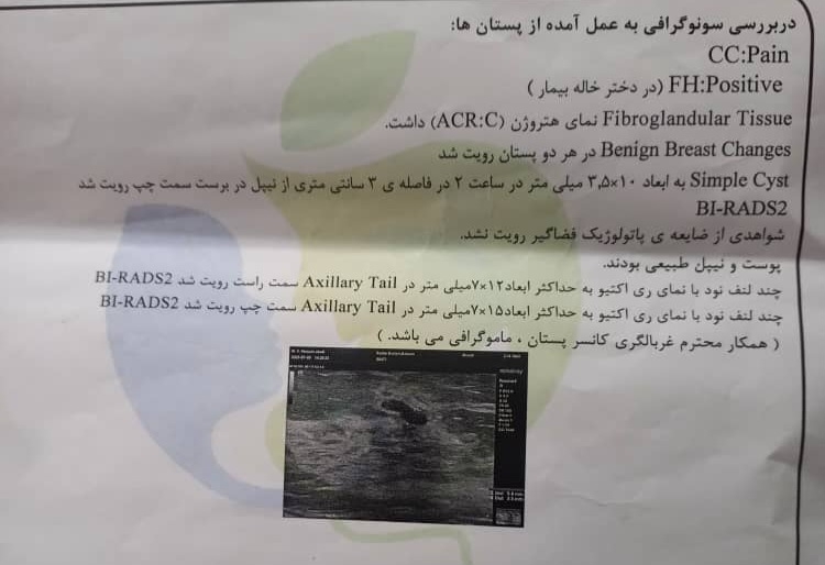 لطفا تفسیر سونوگرافی سینه