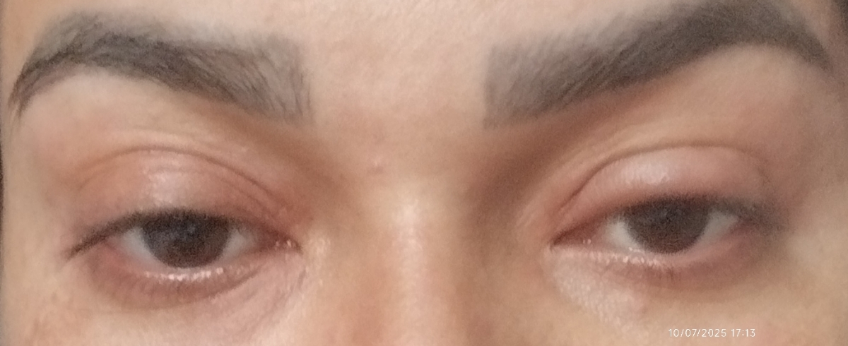 وضعیت چشمام