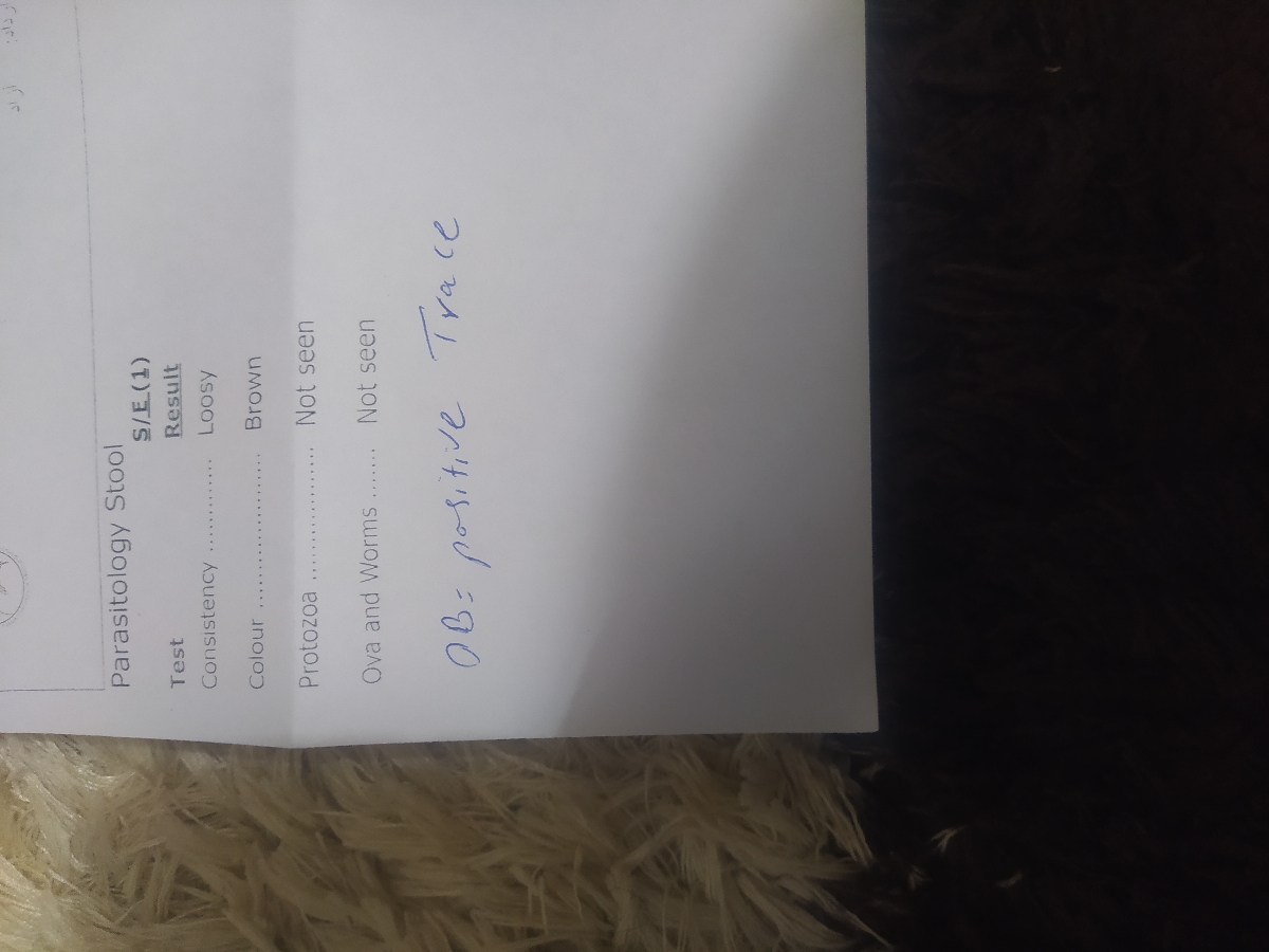 ازمایش پروتین گاوی دخترم ازمایش پروتین گاوی دخترم