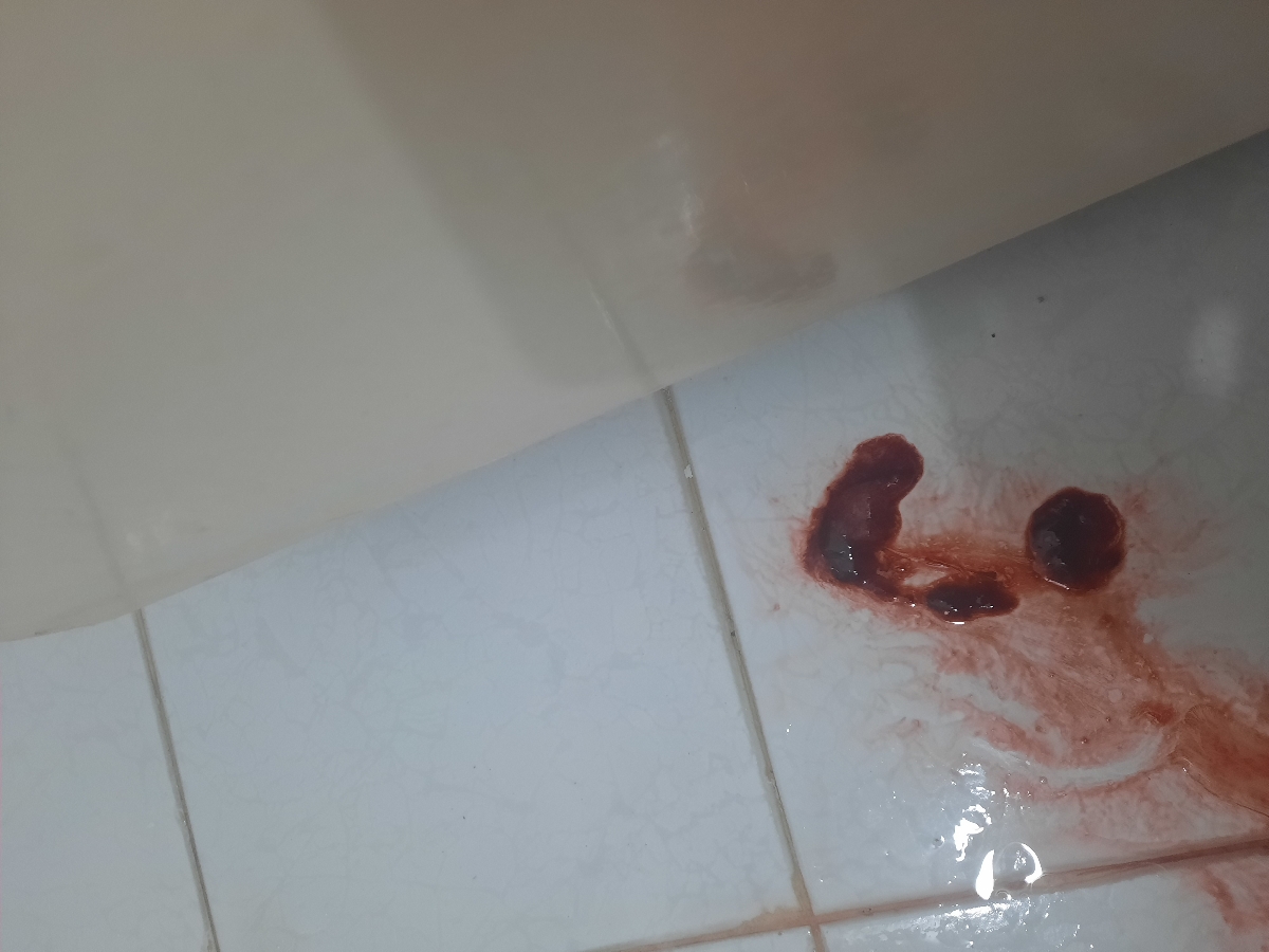ببخشید عکس فرستادم به نظر این جنین سقط شد 
زیر شکم دردمیکنند 