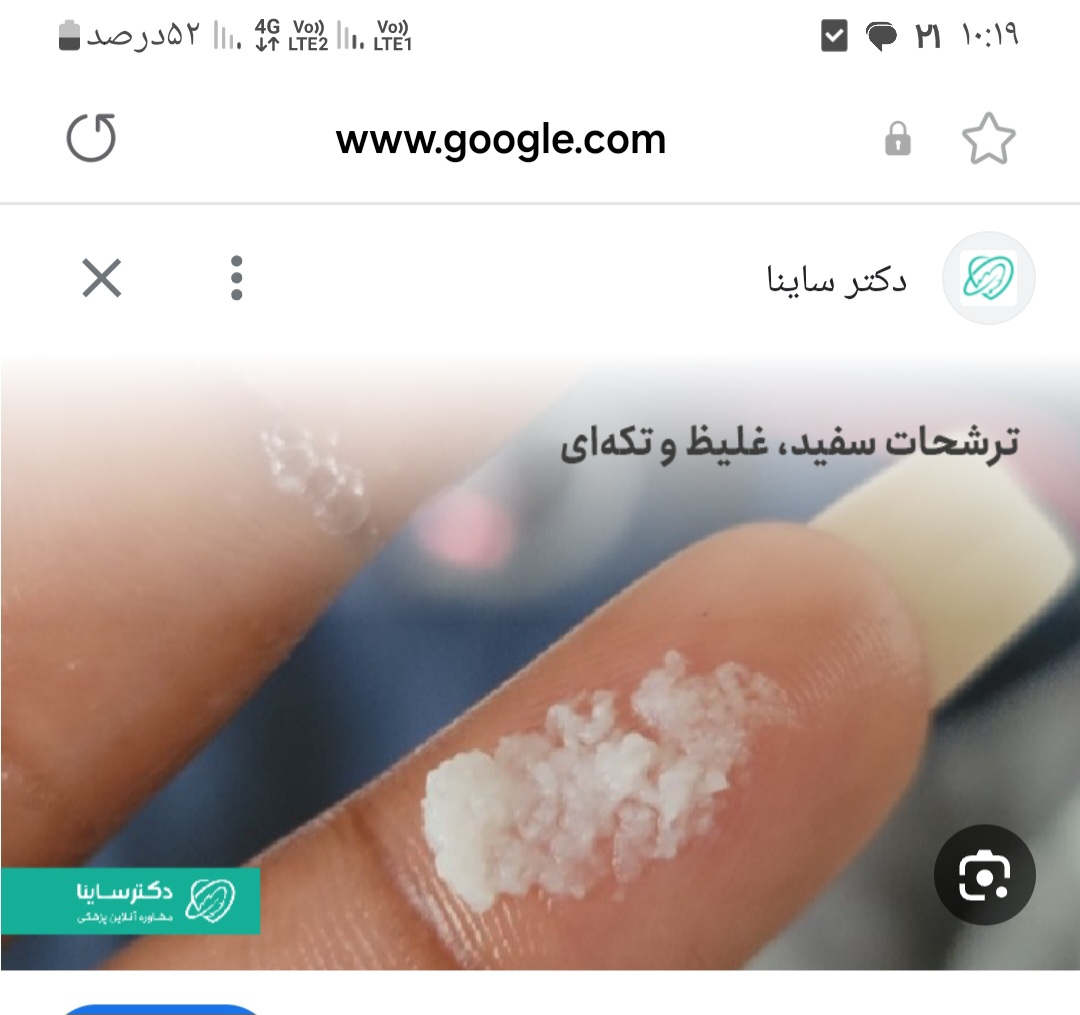 شبیه این نوع ترشح بود ولی دون دونی تر شبیه این نوع ترشح بود ولی دون دونی تر