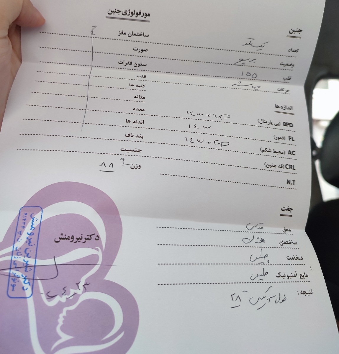 تفسیر سونوگرافی بعد از سرکلاژ