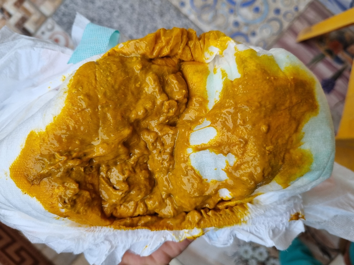 مدفوع نوزاد ۴ ماهه ..خلطی ..حاوی عکس