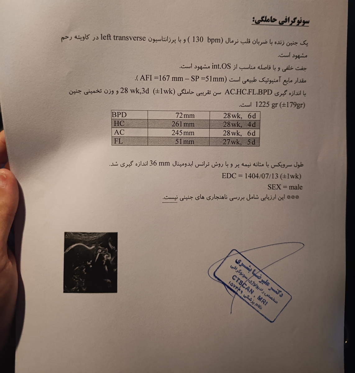 تفسیر سونوگرافی بارداری 🙏