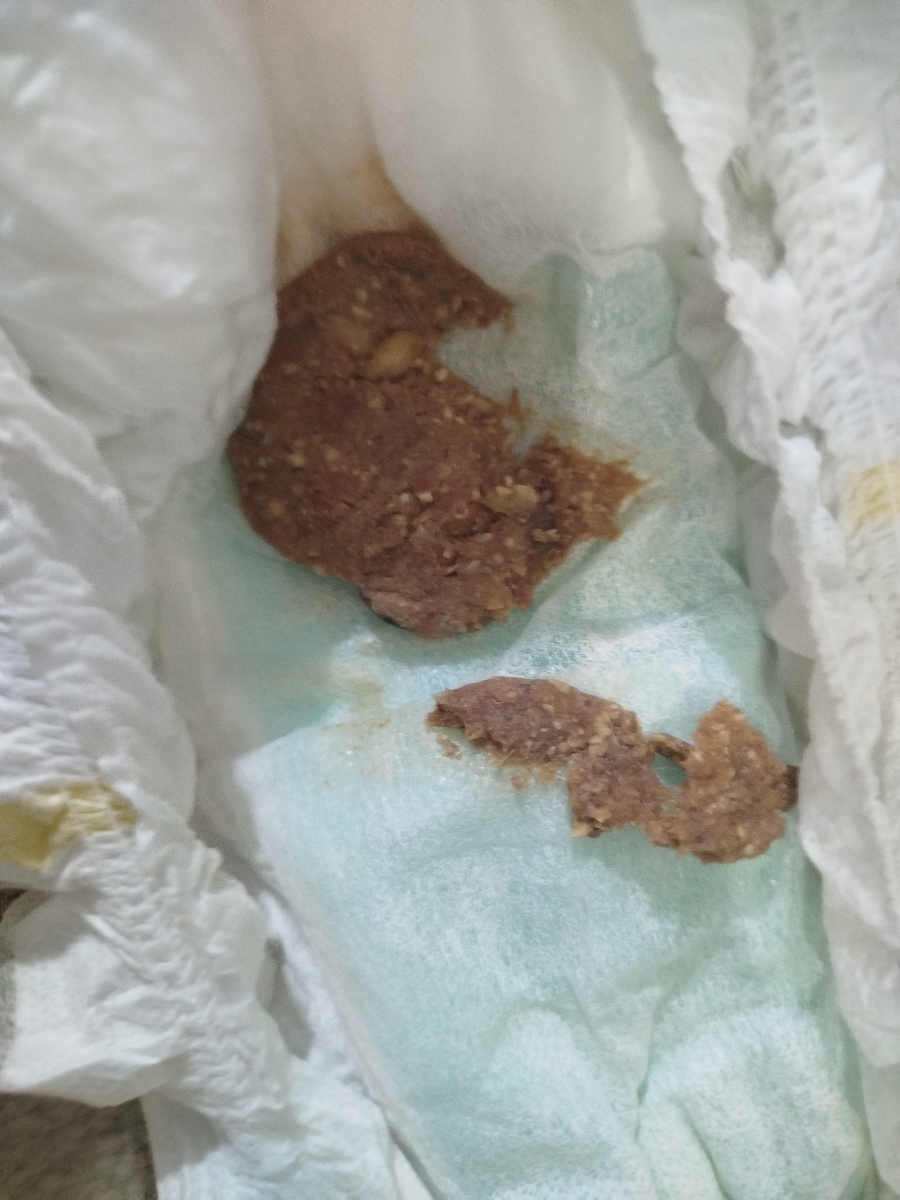 چیکارکنم اسهال پسرم خوب بشه