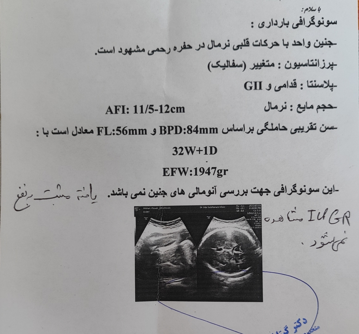 سونو وزن ۳۲ هفته سونو وزن ۳۲ هفته