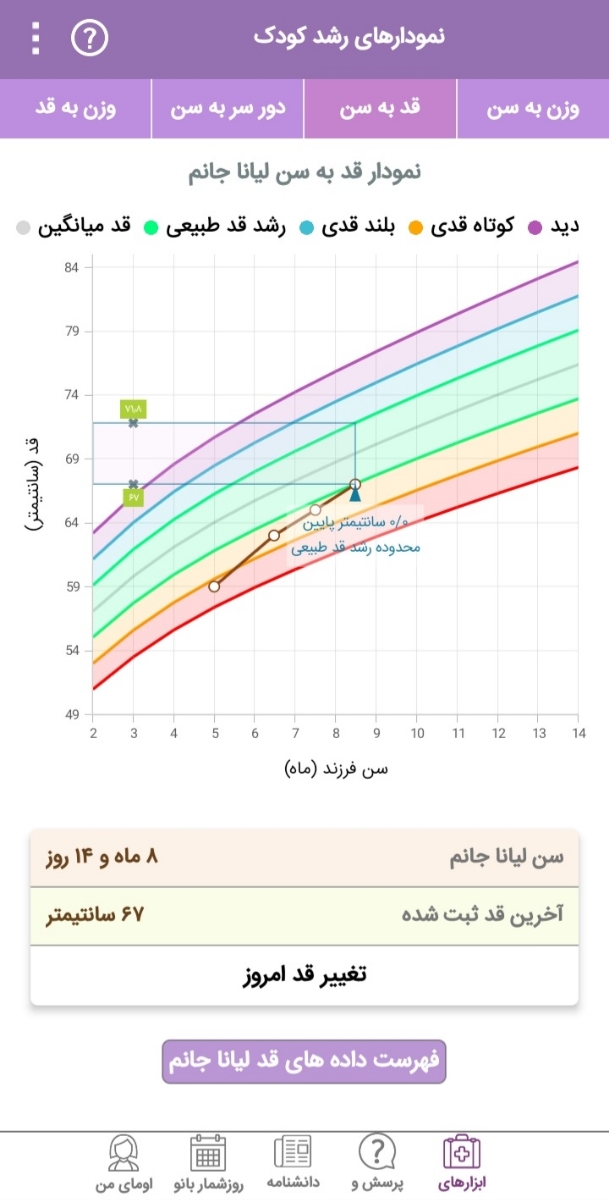 رشد نکردن دور سر نوزاد