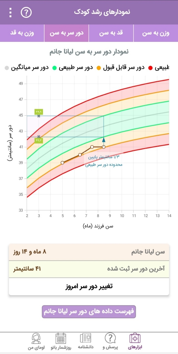 رشد نکردن دور سر نوزاد
