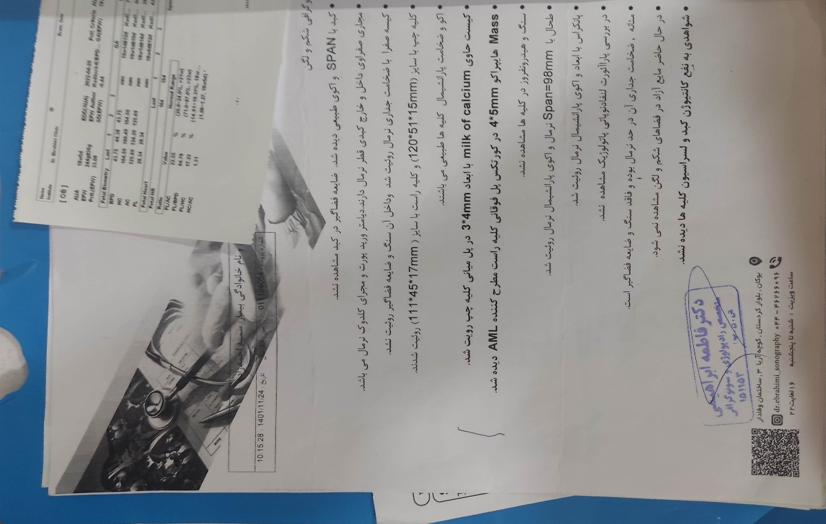 گڎاشتن آیودی مسی و پریودی