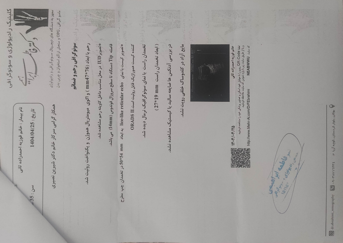گڎاشتن آیودی مسی و پریودی