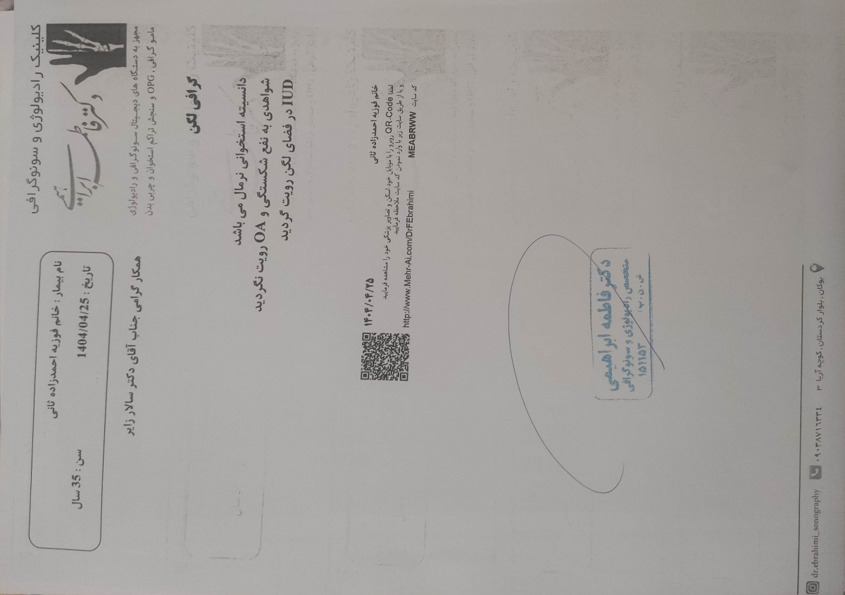 گڎاشتن آیودی مسی و پریودی