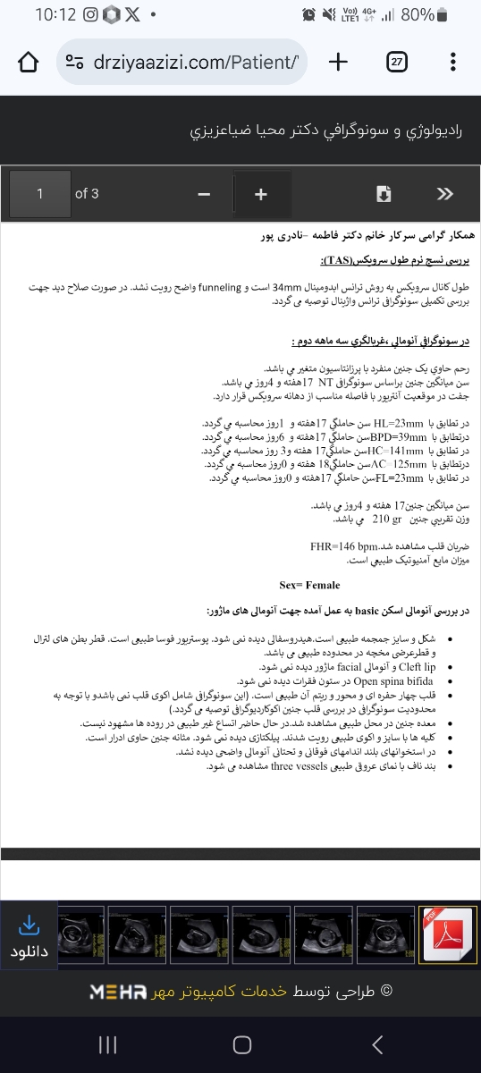 بررسی سونوگرافی انومالی