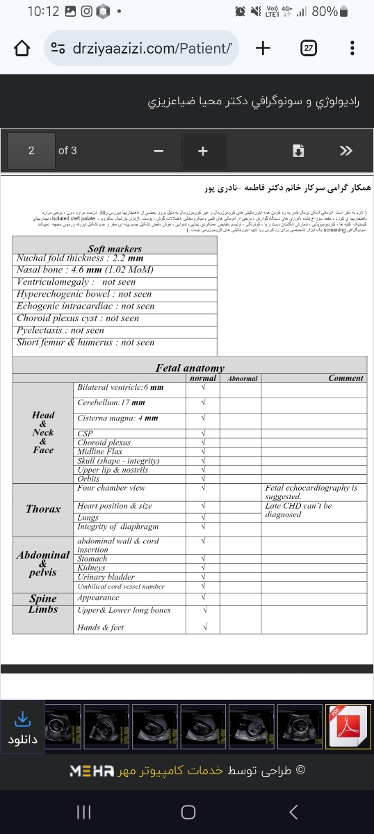 بررسی سونوگرافی انومالی