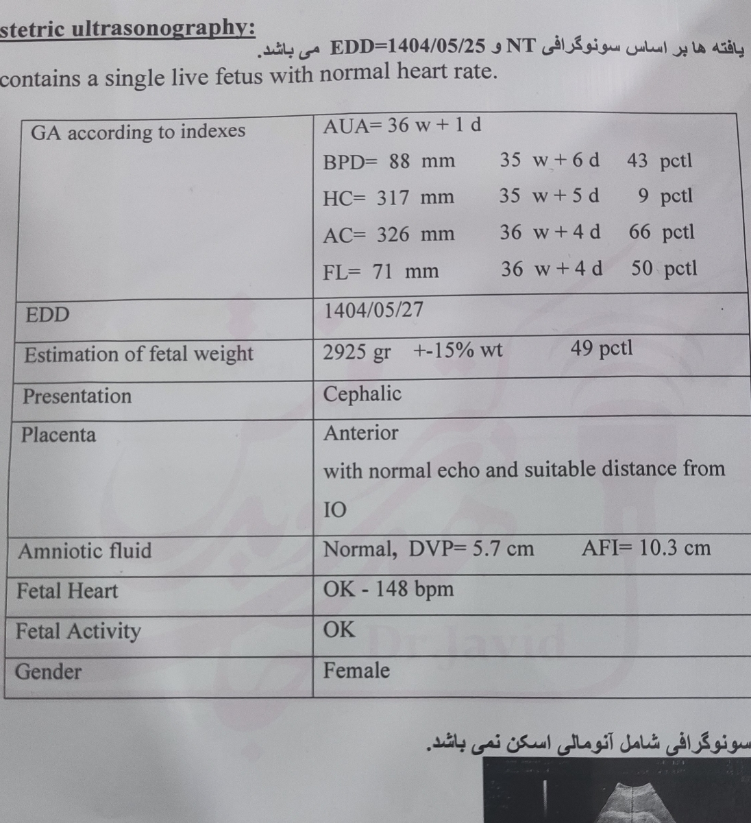 تفسیر سونوگرافی هفته 37