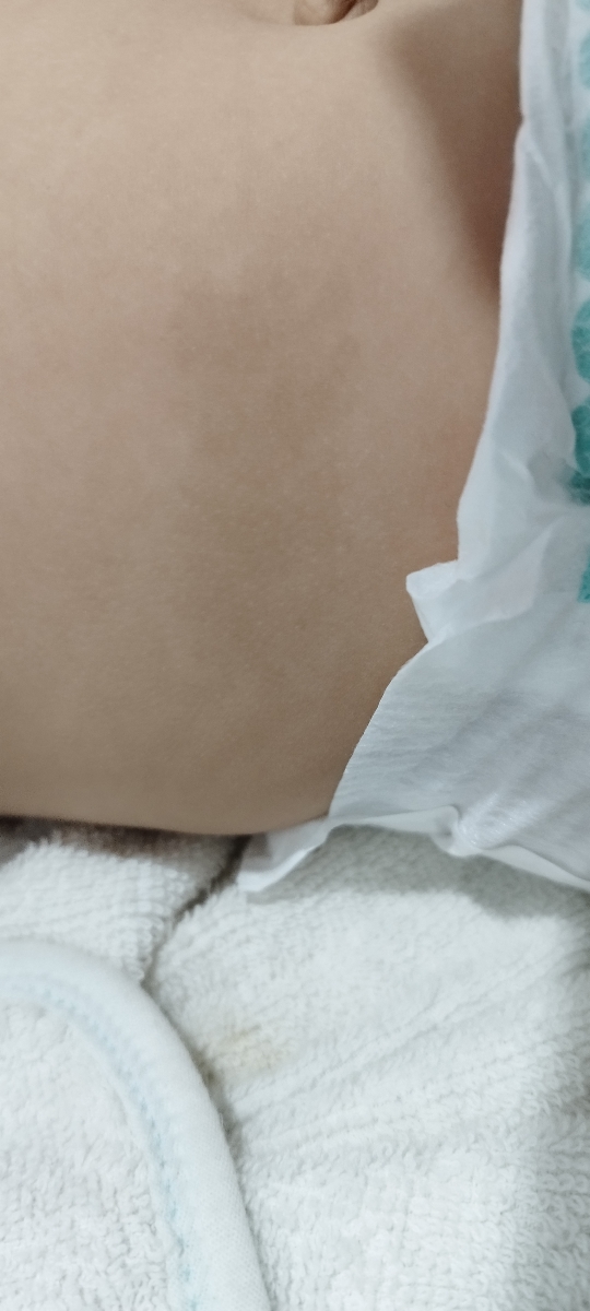 لک روی بدن نوزاد😭😭😭