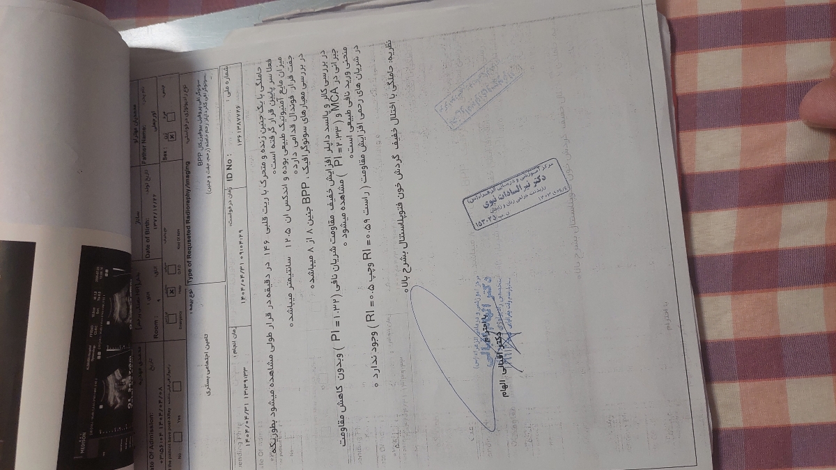 بررسی سونو کالر داپلر