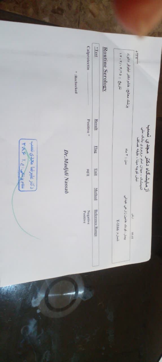 شکستن رژیم پروتئین گاوی شکستن رژیم پروتئین گاوی