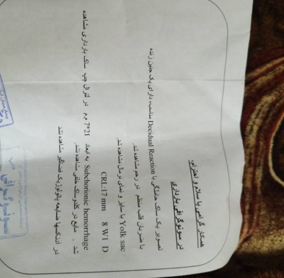 تشخیص جنسیت از روی سونو ان تی