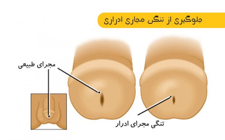 سوراخش باید مثل سمت چپیه حالت خط داشته باشه سوراخش باید مثل سمت چپیه حالت خط داشته باشه