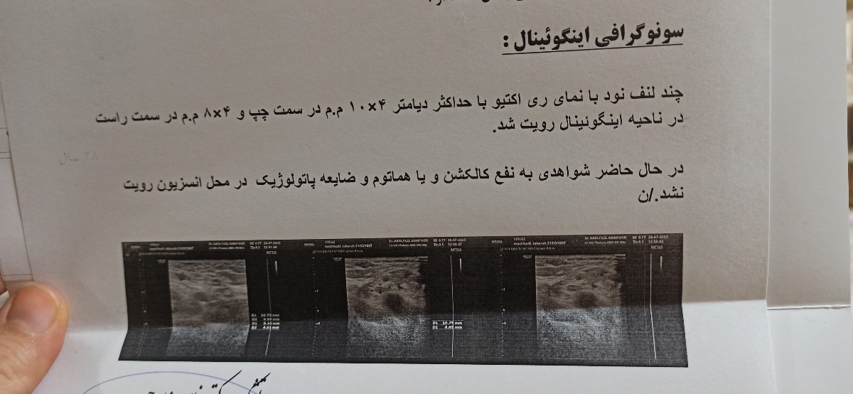 درد زخم سزارین بعددوسال.