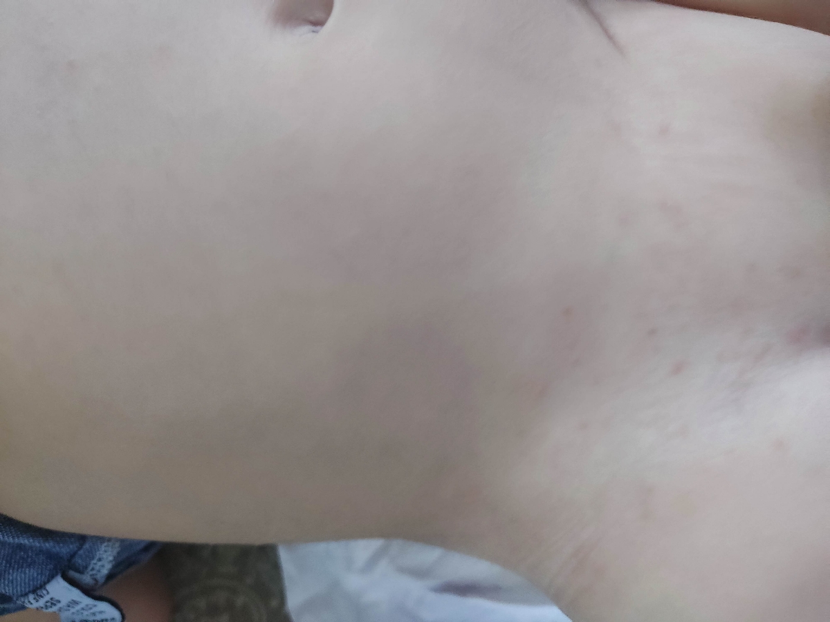 نمیدونم روی شکمش رو متوجه میشین یا نه 