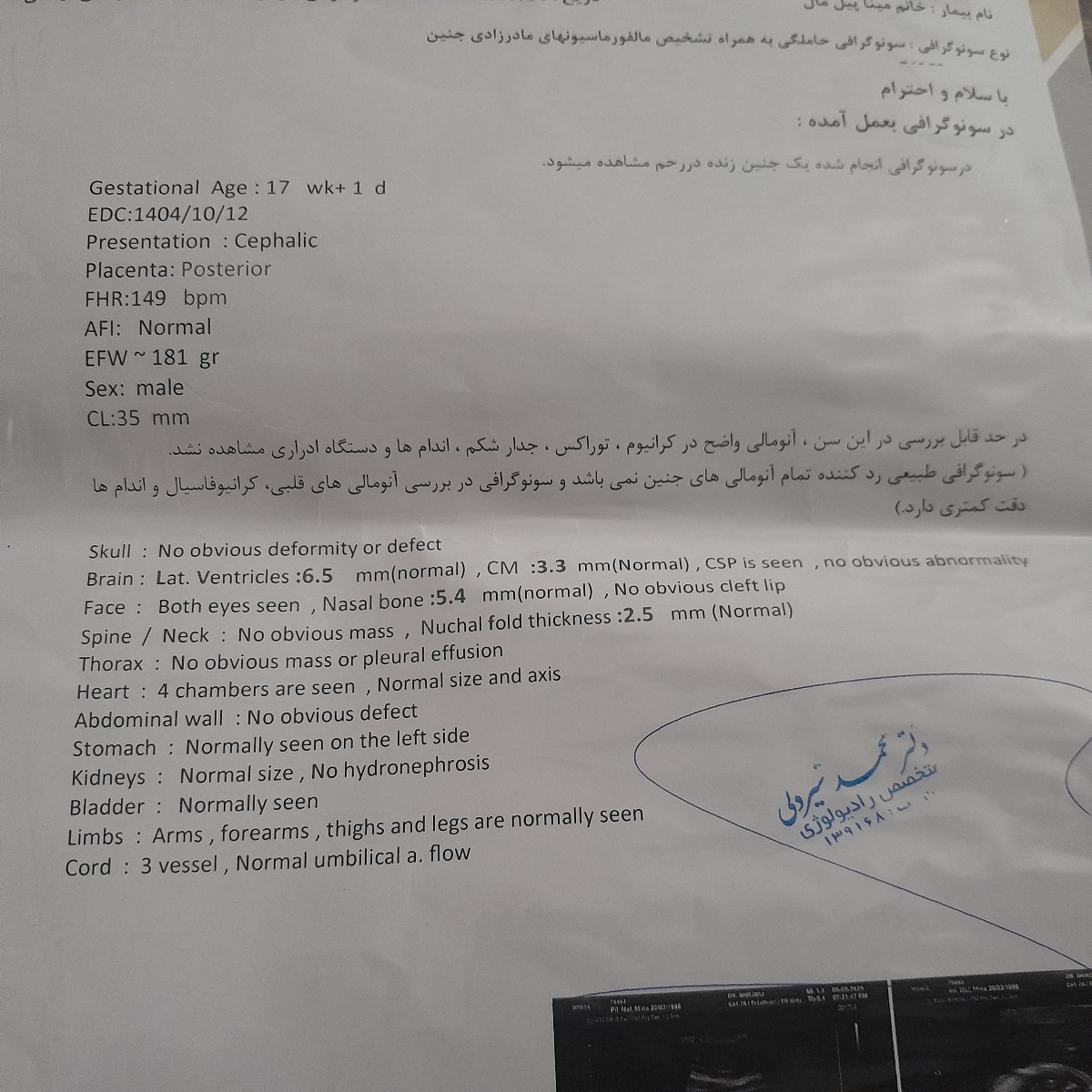 عکس سونوگرافی انومالی و آزمایش خون