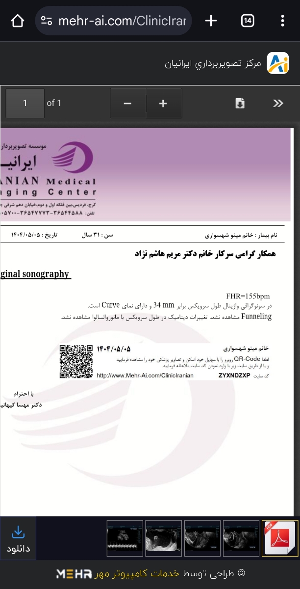 nt و تعیین جنسیت