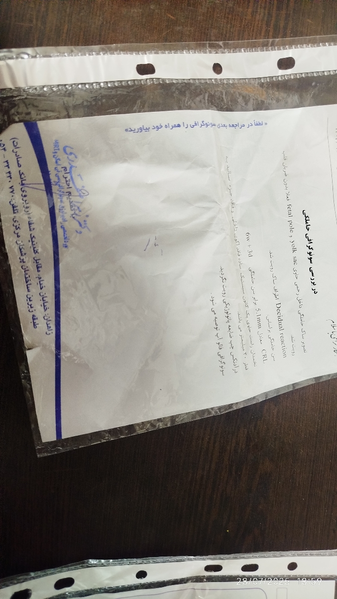 اولین سونو اولین سونو