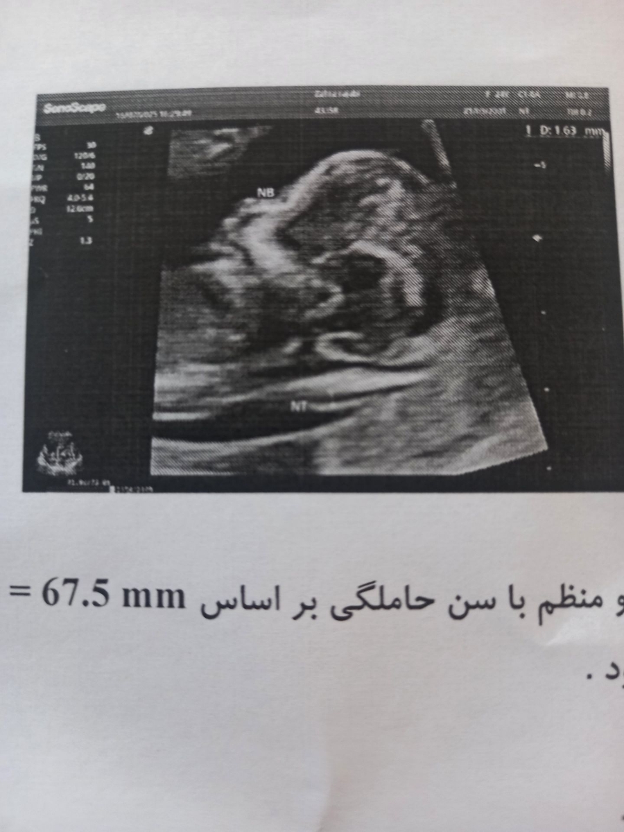 دخملیه یاپسری