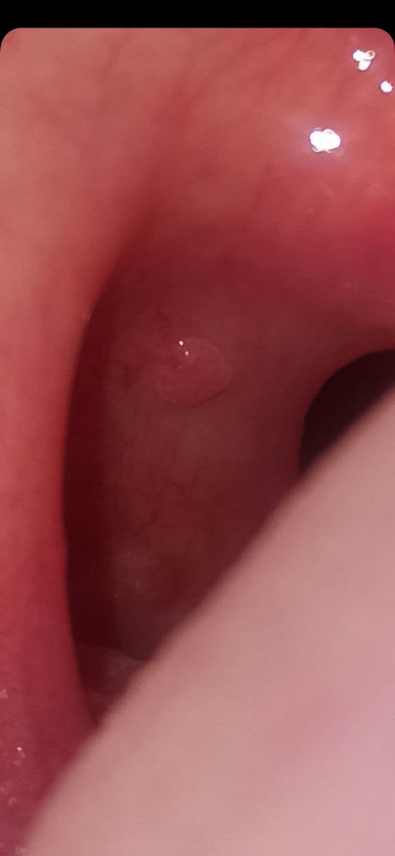 دکتر عزیز سلام چند وقت پیش در رابطه با اچ پی وی دهانی سوال پرسیدم