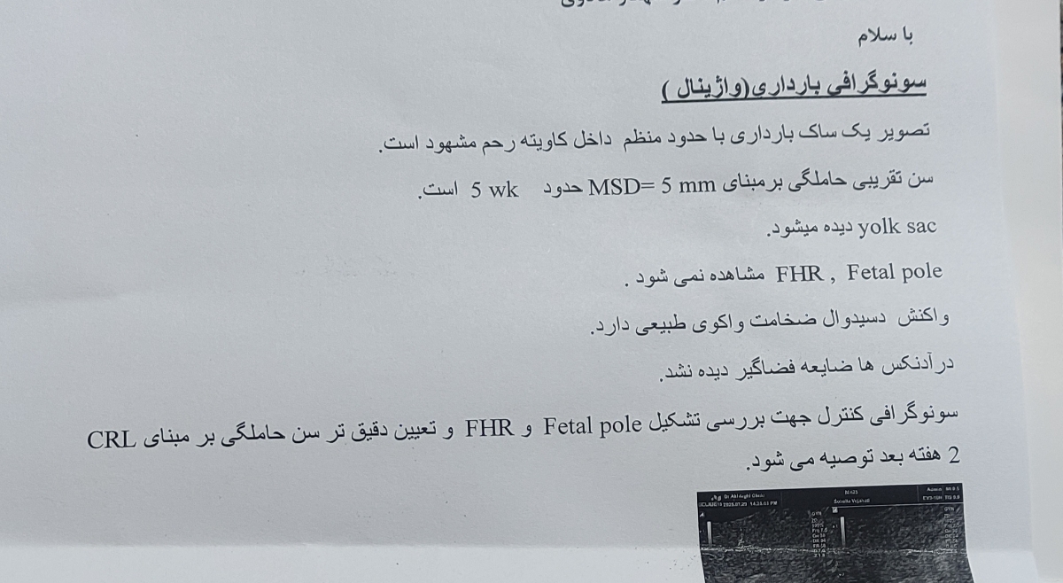 بررسی سونو ی بارداری
