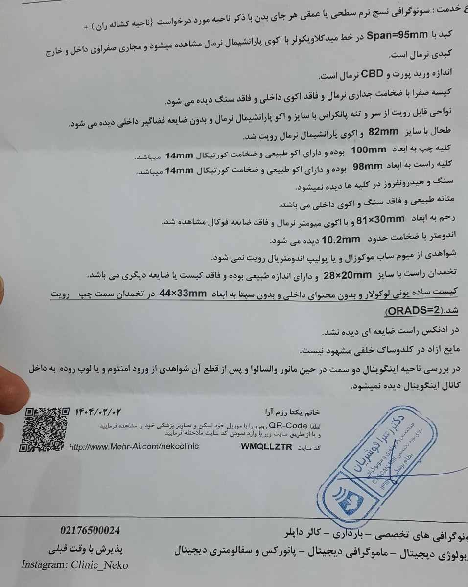 اولین سونوگرافی اولین سونوگرافی
