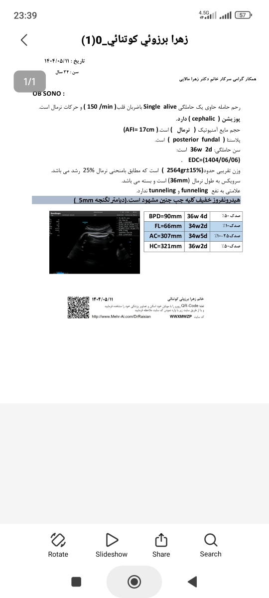 سلام دکتر جان سوال درباره وزن جنین😘😘 سلام دکتر جان سوال درباره وزن جنین😘😘