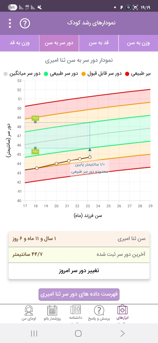 دور سر کودک دو ساله