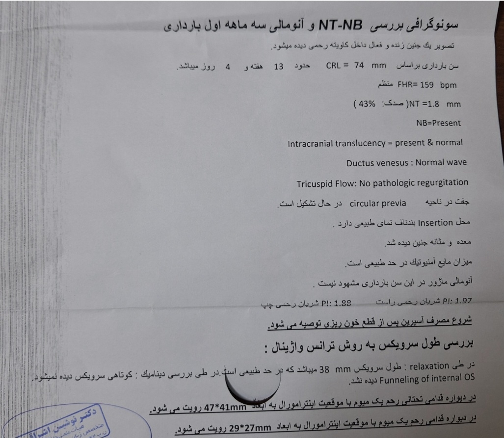 سونو ان تی سونو ان تی