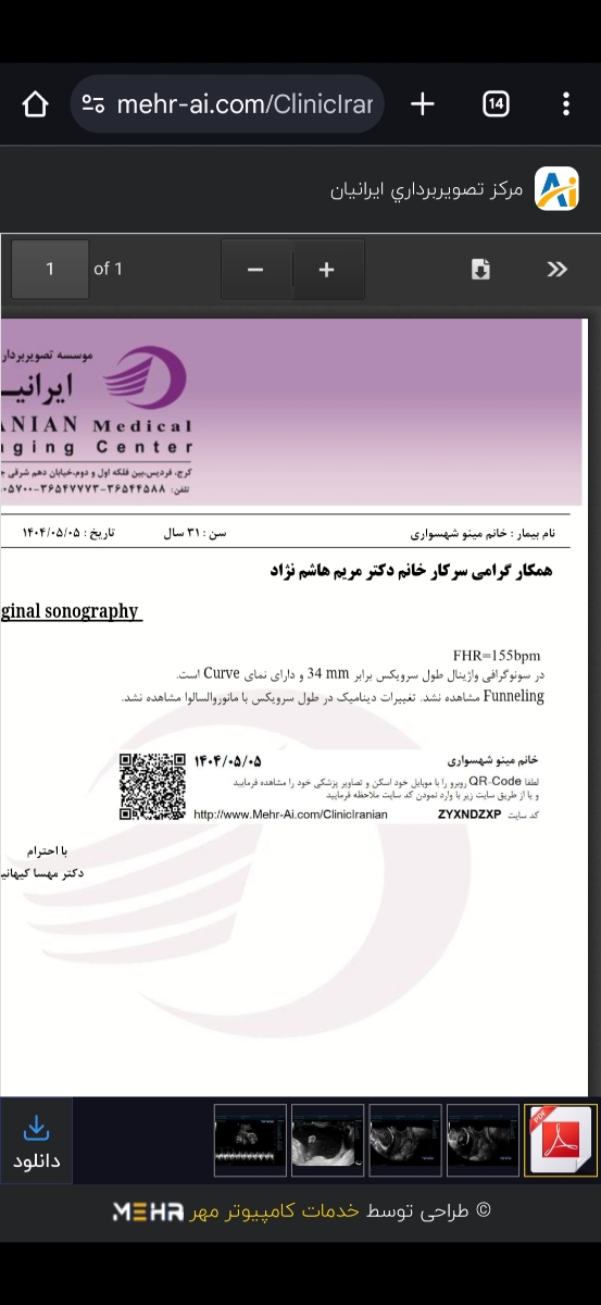 طول سرویکس و اکو قلب جنین طول سرویکس و اکو قلب جنین