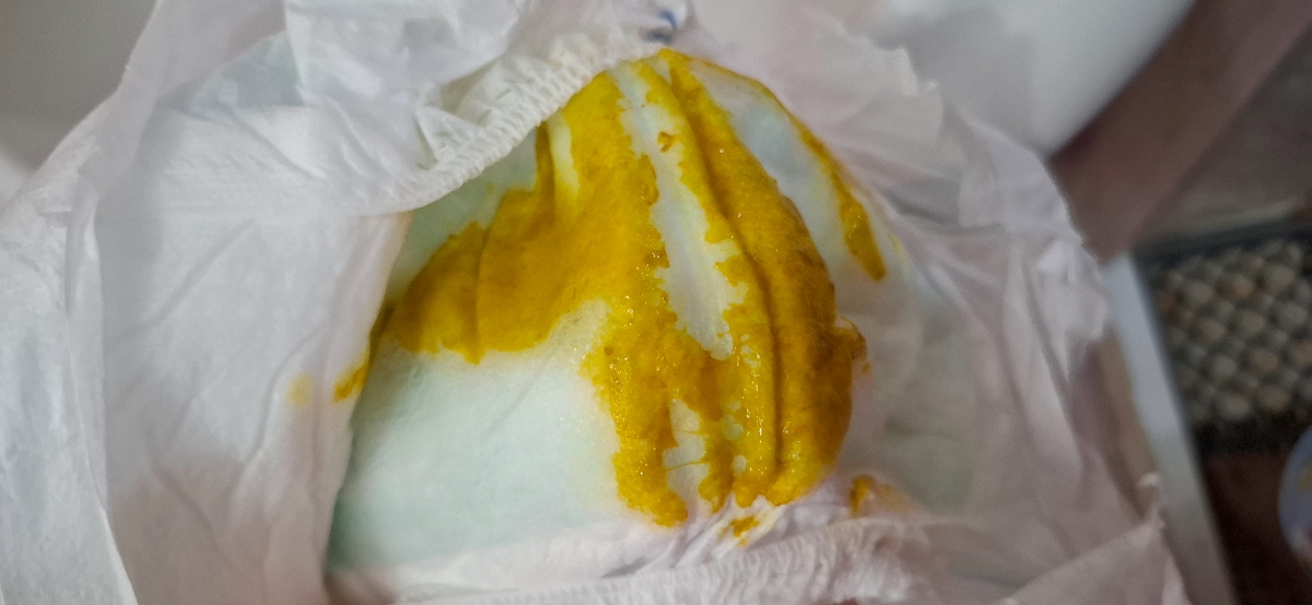 مدفوع نوزاد دو ماهه +عکس مدفوع نوزاد دو ماهه +عکس