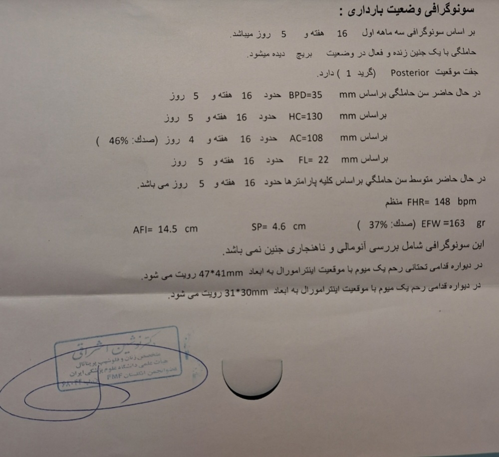 فری بتا هاش سی جی بالا فری بتا هاش سی جی بالا