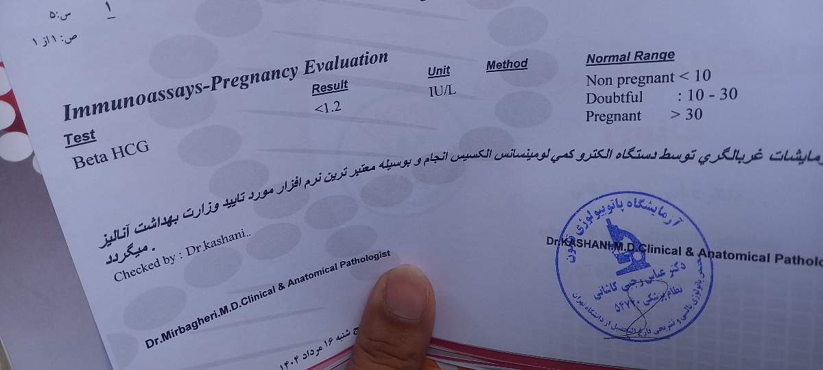آزمایش بتا بارداری