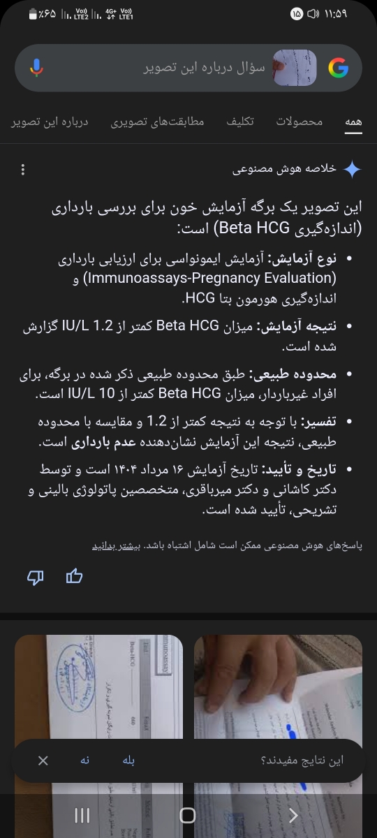 گوگل زدم اینو گفته متوجه نشدم 