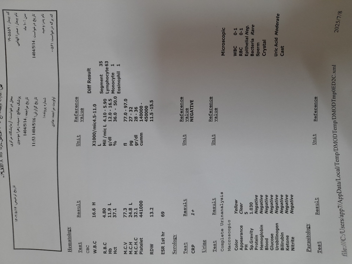 شربت نئوزینک و ودز مصرفیش