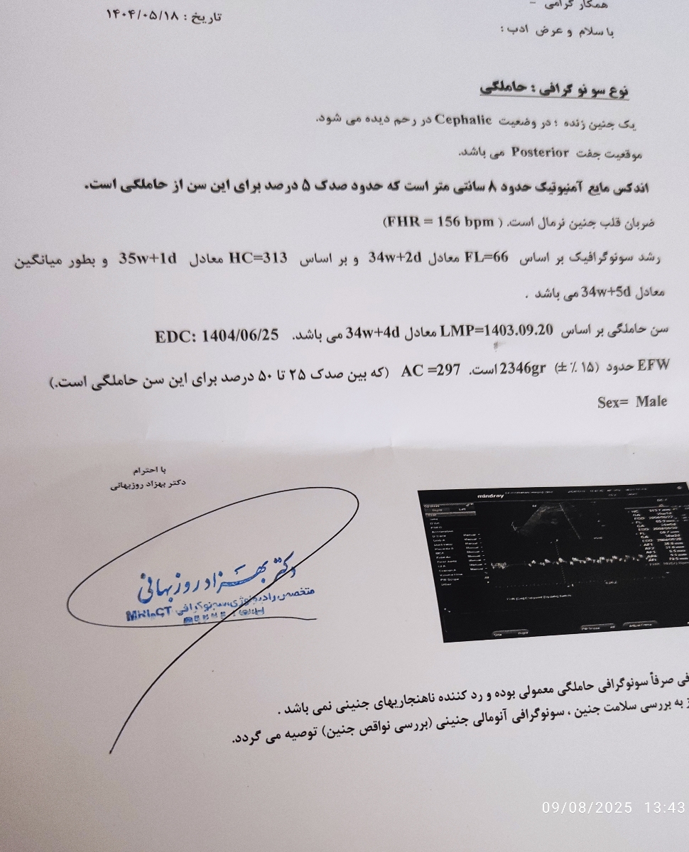 حجم کیسه اب جنین حجم کیسه اب جنین