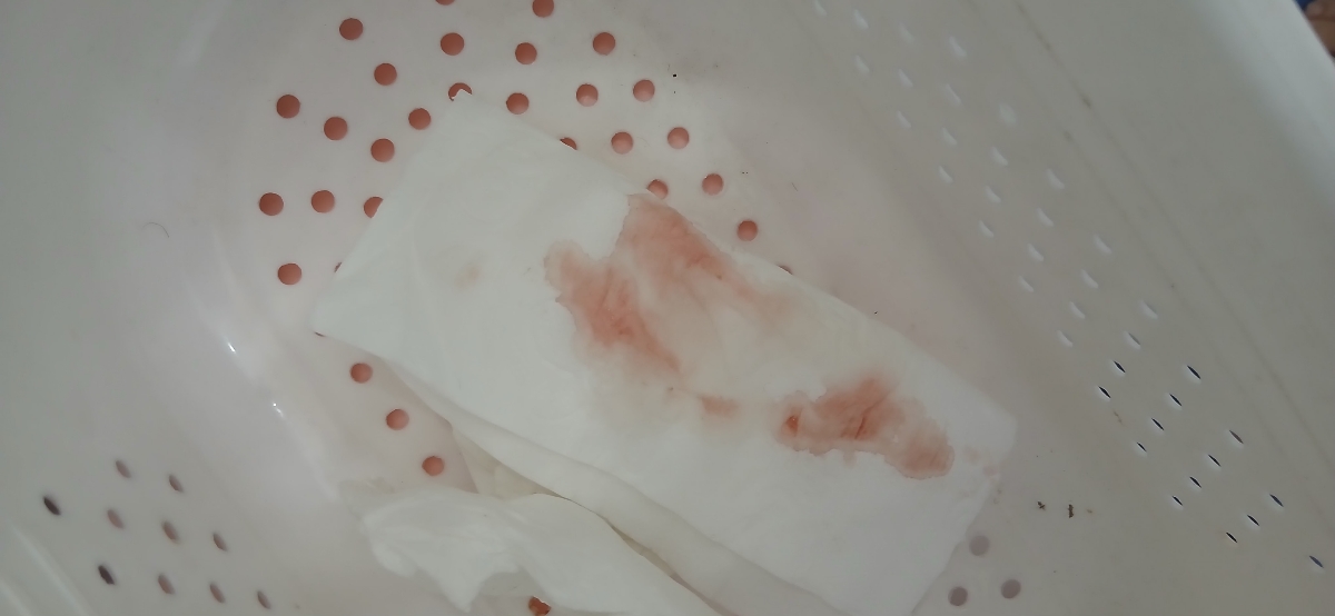 ترشخ خونی هفته ی ۸ بارداری