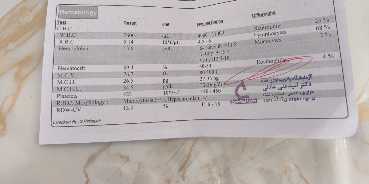 چکاب و آزمایش دوسالگی