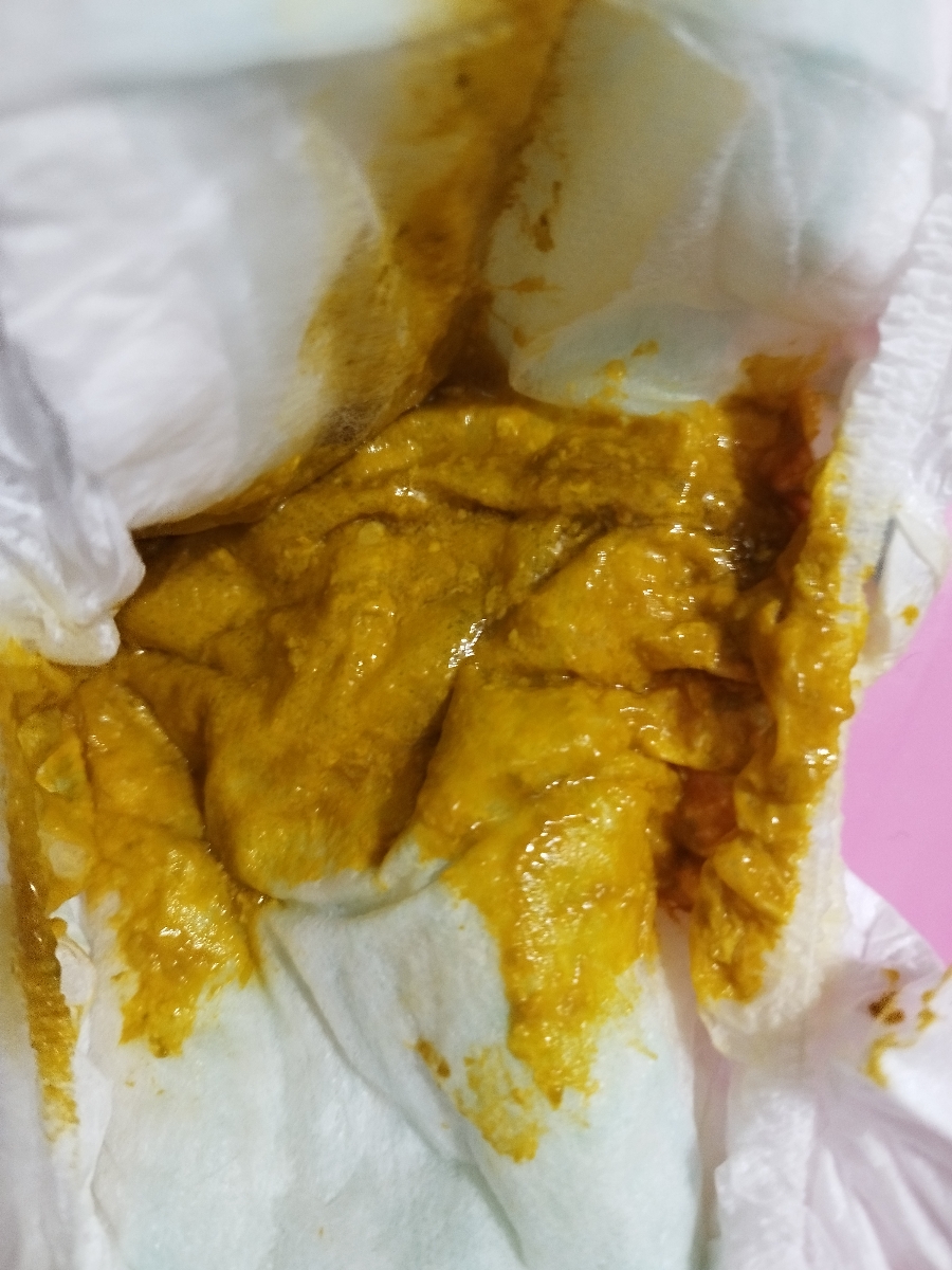 معذرت میخوام بابت عکس معذرت میخوام بابت عکس