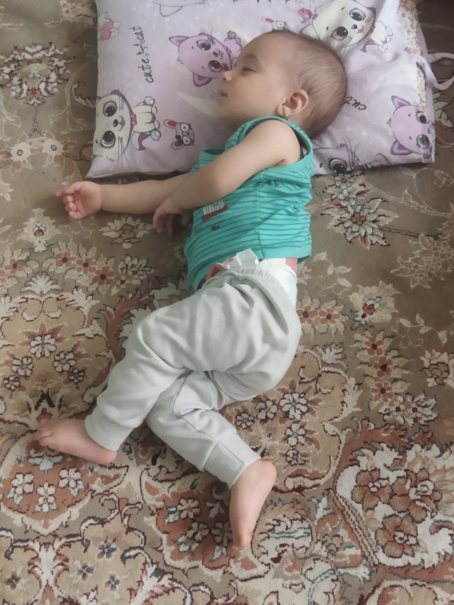 برای رشد موی دخترم چکار کنم